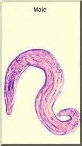 Male pinworm | Threadworm, Science