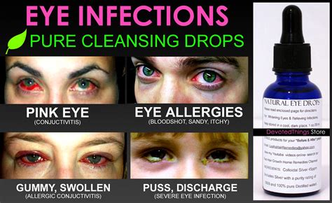 Natural Eye Drops for Pink Eye and Eye Infections Pure Cleansing Drops