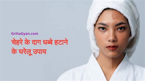 चेहरे के दाग धब्बे हटाने के घरेलू उपाय (Home Remedies To Remove Dark Spots in Hindi)
