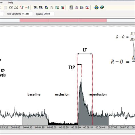 Laser Doppler Flowmetry (LDF) measurement of skin microvascular blood ...