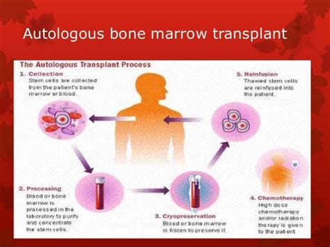 Bone marrow transplant max healthcare kenya