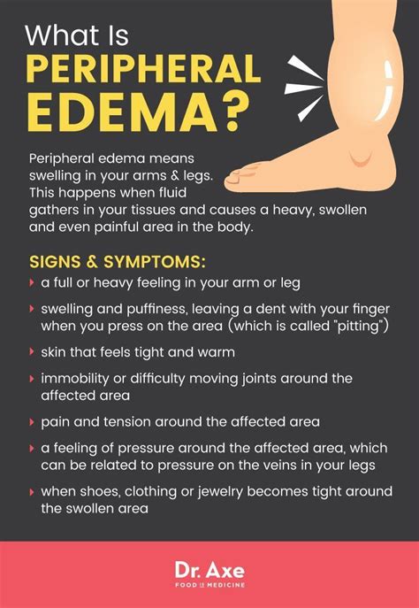 What is peripheral edema? - Dr. Axe http://www.draxe.com #health # ...