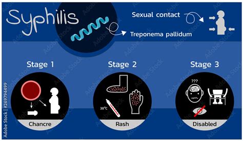 Syphilis Infection Symptoms And Stages Helal Medical – NBKomputer