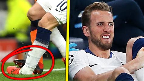 Harry Kane Injury / Harry Kane S Ankle Injury Thought Not To Be As ...