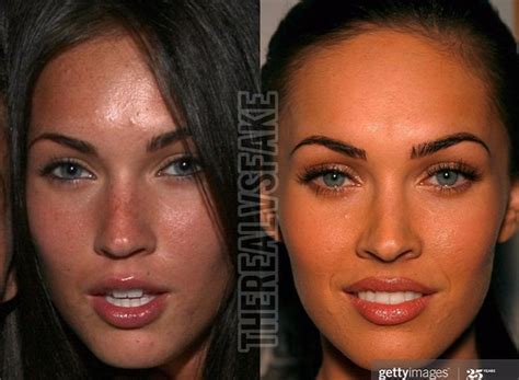 Megan Fox: Before & After Surgery | Fake hair, Facial fillers, Botox ...