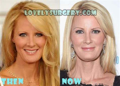 Sandra Lee Plastic Surgery Before and After Picture - Lovely Surgery | Celebrity Before and ...