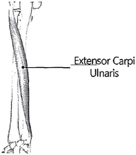 ECU muscle and tendon origin and insertion. | Download Scientific Diagram