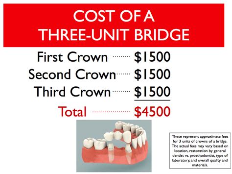 Cost Difference Between Dental Bridge and Dental Implant | Cost Difference Between Dental Bridge ...