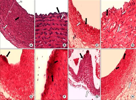 (A) Three layers forming wall of aorta: tunica intima (TI), tunica ...