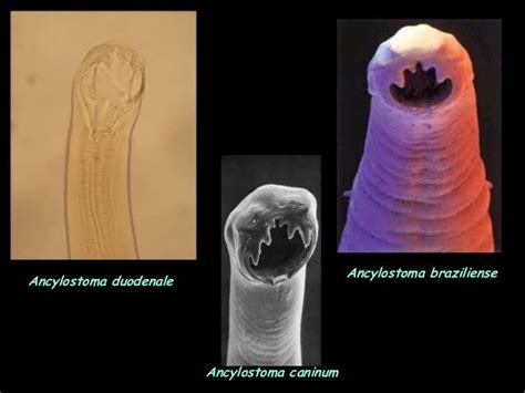 Ancylostomiasis | Parasite, Pandora screenshot, Larvae