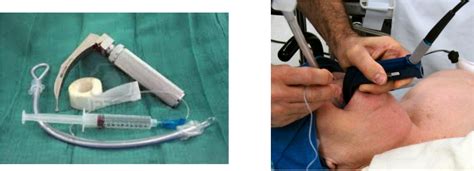 Prepare for Intubation - ICU EMERGENCY HOW TO REACT