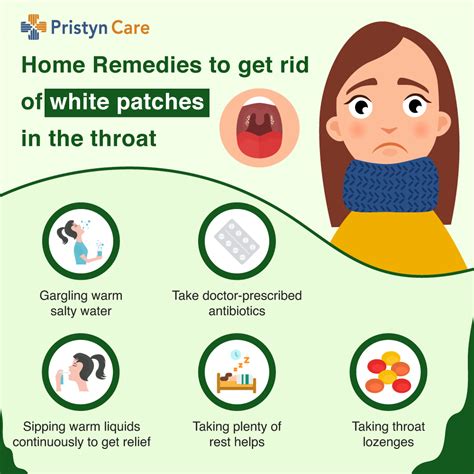 A Must Read For White Spots on the Throat: Doctor's Advice