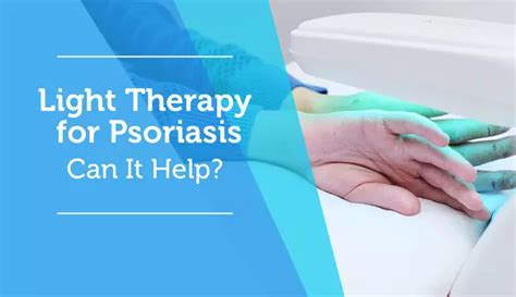 Light Therapy for Psoriasis: Can It Help? | MyPsoriasisTeam