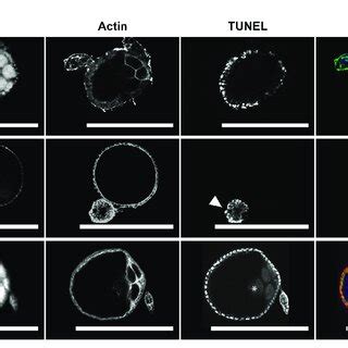 Follicular atresia is apoptotic in Ae. triseriatus. (A) Early-stage... | Download Scientific Diagram