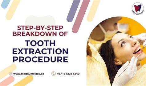 Step-By-Step Breakdown of Tooth Extraction Procedure