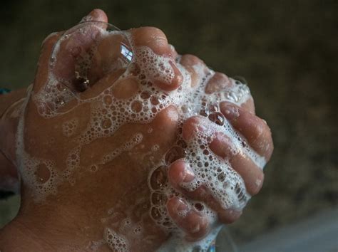 What Causes Clammy Hands? 7 Reasons & How To Stop It