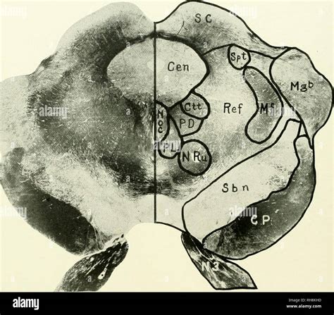 Cerebral peduncle hi-res stock photography and images - Alamy