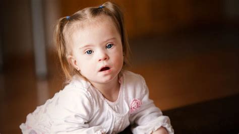 These Adorable Pictures of Kids with Down Syndrome Prove Iceland’s Push to ‘Eradicate’ the ...