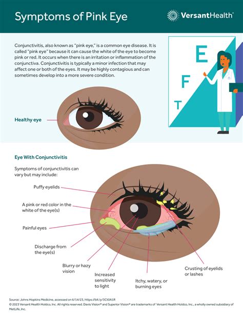 Symptoms of Pink Eye - Versant Health