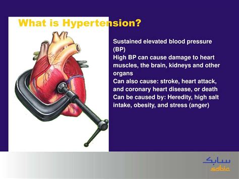 PPT - HYPERTENSION PowerPoint Presentation, free download - ID:4156345