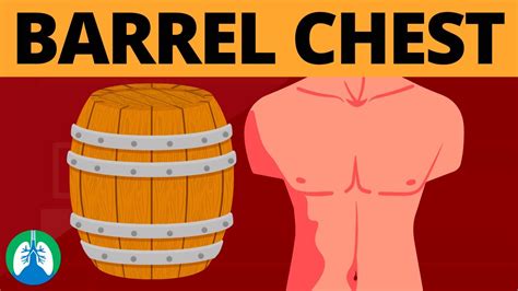 Barrel Chest (Medical Definition) | Quick Explainer Video - YouTube