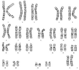 KARYOTYPING – Kathmandu Center for Genomics and Research Laboratory