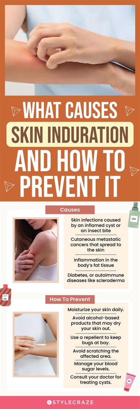 Skin Induration: Symptoms, Causes, And Treatments