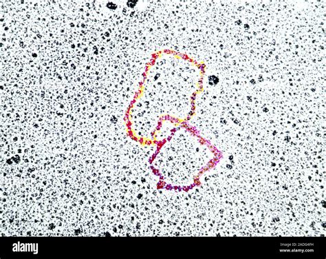 Bacterial plasmids. Coloured Transmission Electron Micrograph (TEM) of ...