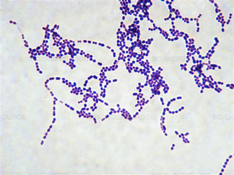 Science Source - Streptococcus Pyogenes