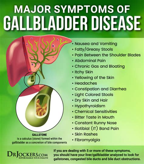 22 Symptoms of GallBladder Disease - DrJockers.com