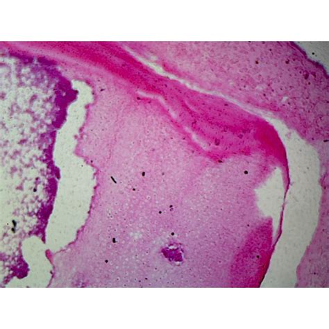 Red Bone Marrow, Mammalian; Showing Giant Blood Cells; Section; H&E Stain - Walmart.com ...