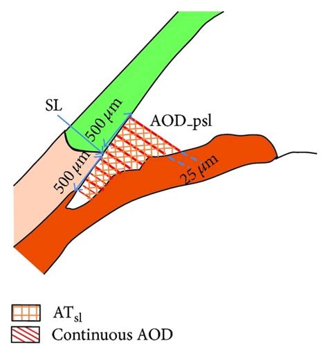 (a) Biometric parameter measurement in SS-OCT image. (b) Extracted... | Download Scientific Diagram