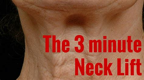 Botox neck lift - YouTube | Neck lift, Botox, Facial muscles