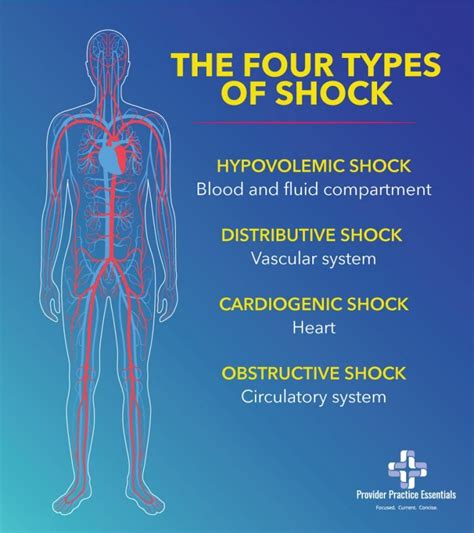 Different Types of Shock and Therapeutive Interventions | PPE Medical