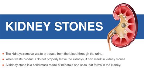 Kidney Stones - Signs, Symptoms, and Treatment - Dr Lal PathLabs Blog