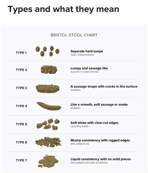 What to know about the Bristol Stool Form Scale | Natural stool softener, Stool softener ...