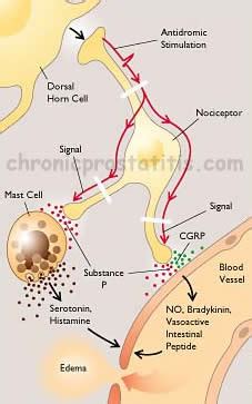 Neurogenic Inflammation