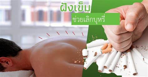 ฝังเข็มต่อการเลิกบุหรี่-Quit smoking with acupuncture| Lekang Clinic ...