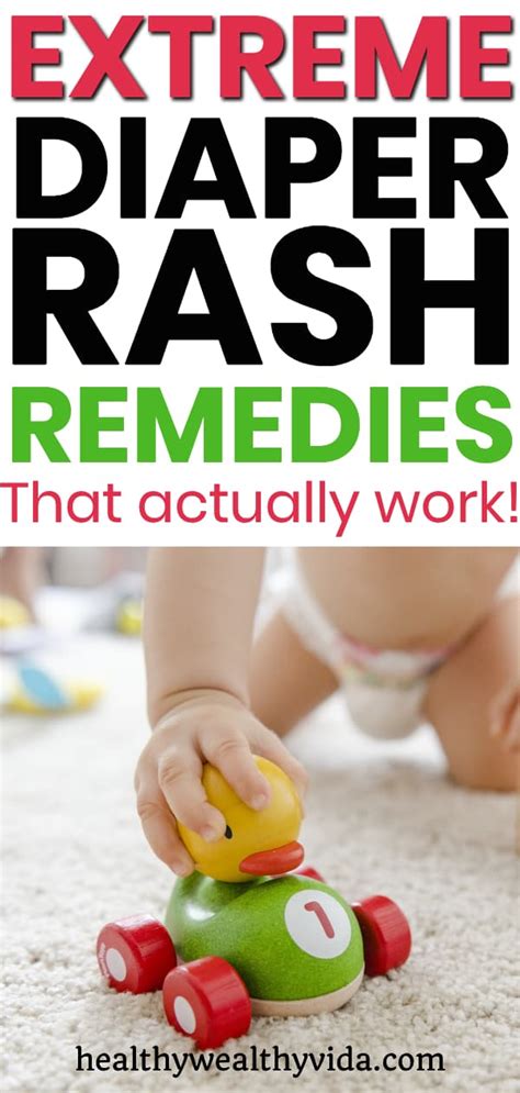 Extreme Diaper Rash Remedies That Actually Work - Healthy Wealthy Vida