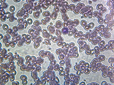 GSC International PS0317 Human Iron-Deficient Anemia Blood Smear - Microscope Slide - Walmart.com