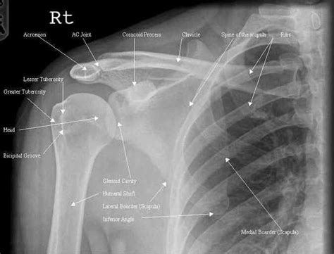 Medical knowledge, Medical anatomy, Radiology student