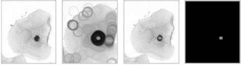 Extracting an inner marker for a free-lying cell nucleus. (a) Original ...