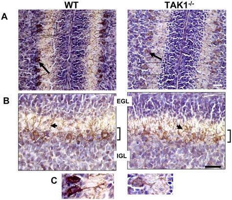 Representation immunohistochemical staining for calbindin 28K ...