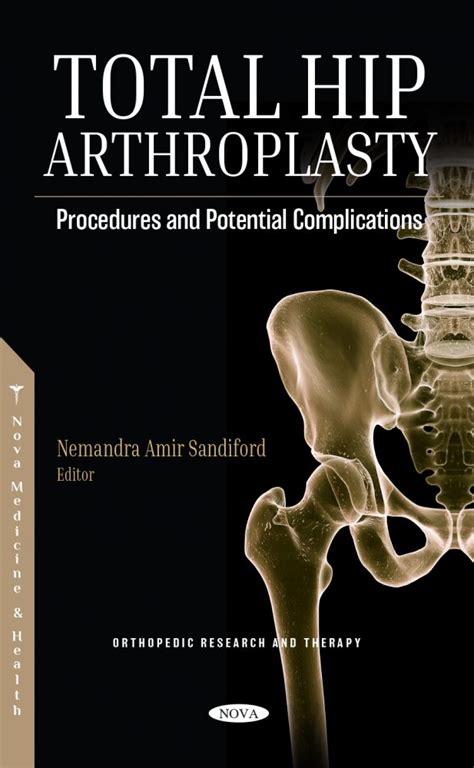 Total Hip Arthroplasty: Procedures and Potential Complications – Nova Science Publishers