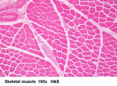 Skeletal Muscle Histology - Skeletal muscle - histology slide