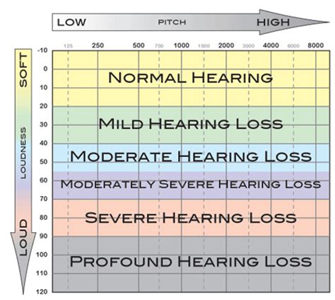 HEARING LOSS , AUDIOGRAM INTERPRETATION