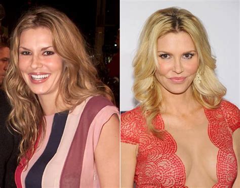 Take a Look at Brandi Glanville Before and after Plastic Surgery and See the Difference! » Honor ...