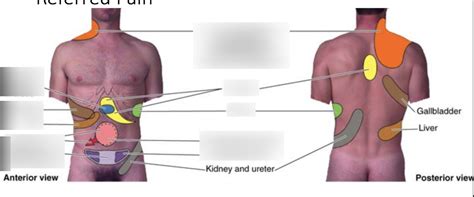 Gallbladder Pain Location Diagram