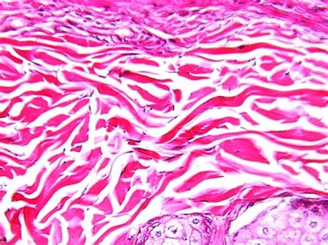 DENSE CONNECTIVE TISSUE | Microanatomy Web Atlas | Gwen V. Childs, Ph.D.