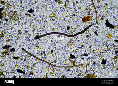 Fungal and fungi hyphae under the microscope in the soil and compost ...